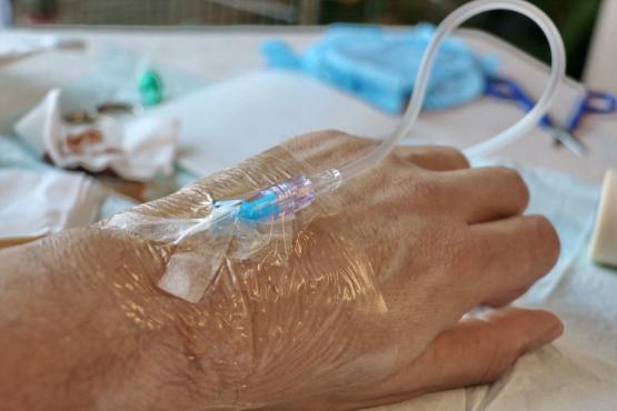 Perfusion Perfusion